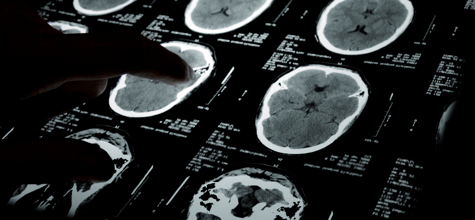 Neuropsychiatric Conditions